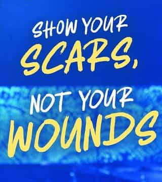 Steven Furtick - Show Your Scars, Not Your Wounds